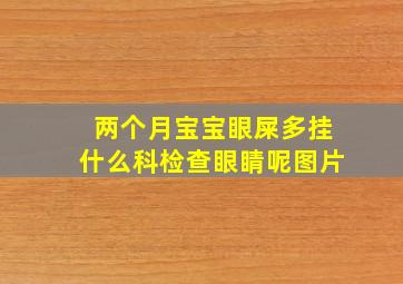 两个月宝宝眼屎多挂什么科检查眼睛呢图片