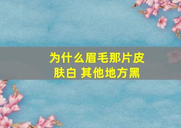 为什么眉毛那片皮肤白 其他地方黑