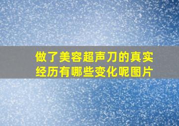 做了美容超声刀的真实经历有哪些变化呢图片