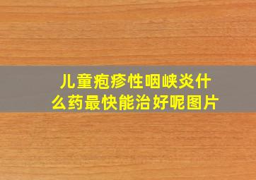 儿童疱疹性咽峡炎什么药最快能治好呢图片