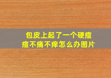 包皮上起了一个硬痘痘不痛不痒怎么办图片