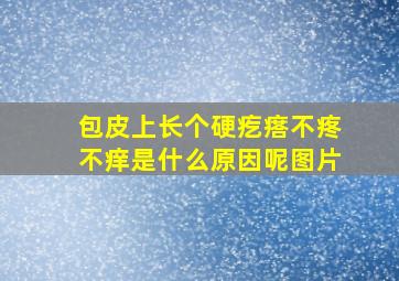 包皮上长个硬疙瘩不疼不痒是什么原因呢图片