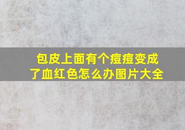 包皮上面有个痘痘变成了血红色怎么办图片大全