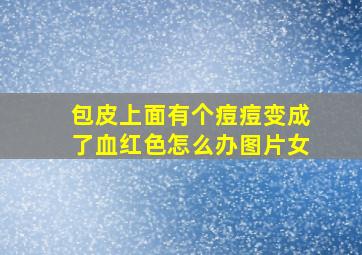 包皮上面有个痘痘变成了血红色怎么办图片女