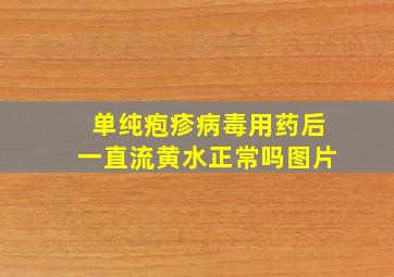 单纯疱疹病毒用药后一直流黄水正常吗图片