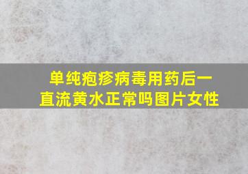 单纯疱疹病毒用药后一直流黄水正常吗图片女性