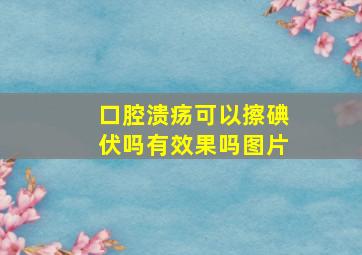 口腔溃疡可以擦碘伏吗有效果吗图片