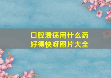 口腔溃疡用什么药好得快呀图片大全