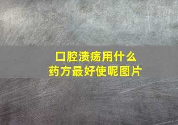 口腔溃疡用什么药方最好使呢图片