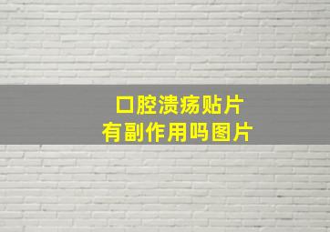 口腔溃疡贴片有副作用吗图片