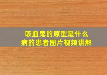 吸血鬼的原型是什么病的患者图片视频讲解