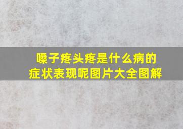 嗓子疼头疼是什么病的症状表现呢图片大全图解