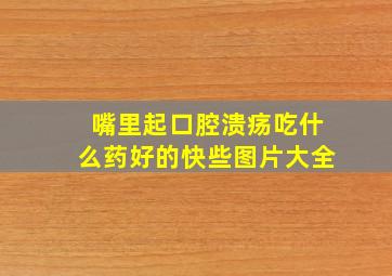 嘴里起口腔溃疡吃什么药好的快些图片大全