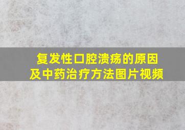 复发性口腔溃疡的原因及中药治疗方法图片视频