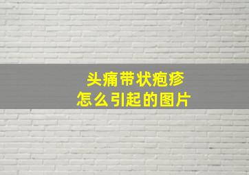 头痛带状疱疹怎么引起的图片