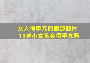 女人得甲亢的面部图片13岁小女孩会得甲亢吗