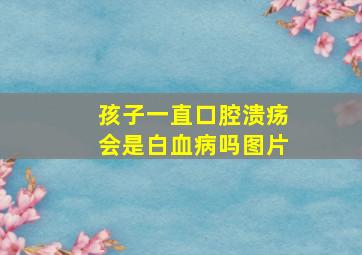 孩子一直口腔溃疡会是白血病吗图片