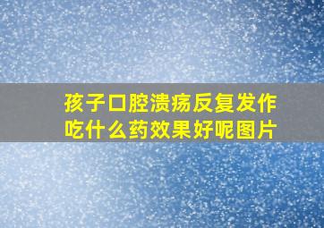 孩子口腔溃疡反复发作吃什么药效果好呢图片