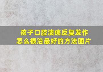 孩子口腔溃疡反复发作怎么根治最好的方法图片