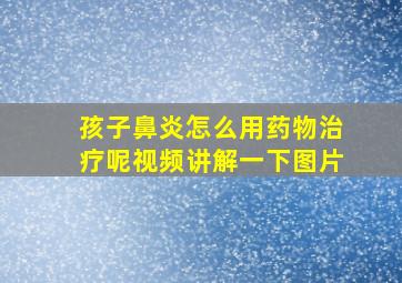 孩子鼻炎怎么用药物治疗呢视频讲解一下图片