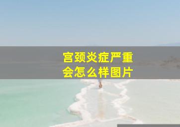 宫颈炎症严重会怎么样图片