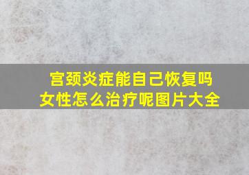 宫颈炎症能自己恢复吗女性怎么治疗呢图片大全