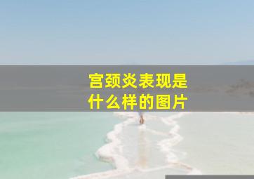 宫颈炎表现是什么样的图片