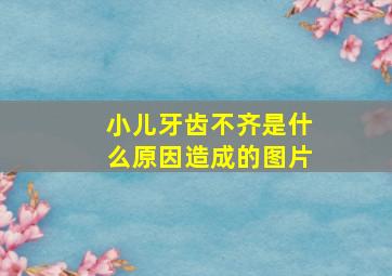 小儿牙齿不齐是什么原因造成的图片