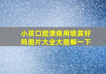 小孩口腔溃疡用喷雾好吗图片大全大图解一下