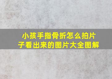 小孩手指骨折怎么拍片子看出来的图片大全图解