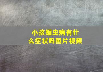 小孩蛔虫病有什么症状吗图片视频