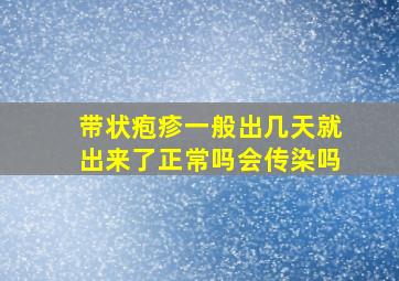 带状疱疹一般出几天就出来了正常吗会传染吗