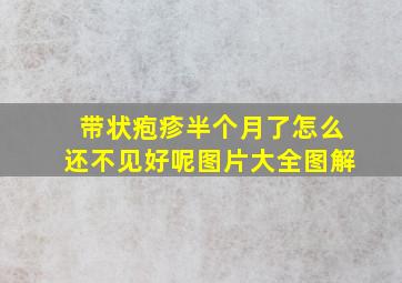 带状疱疹半个月了怎么还不见好呢图片大全图解