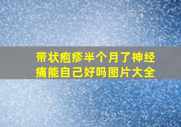 带状疱疹半个月了神经痛能自己好吗图片大全