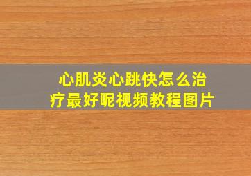 心肌炎心跳快怎么治疗最好呢视频教程图片