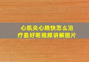 心肌炎心跳快怎么治疗最好呢视频讲解图片