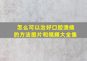 怎么可以治好口腔溃疡的方法图片和视频大全集