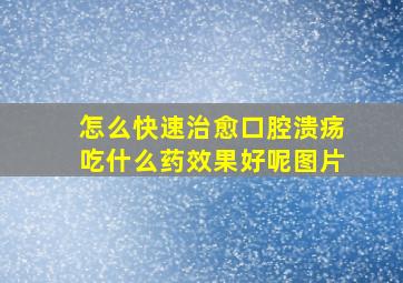 怎么快速治愈口腔溃疡吃什么药效果好呢图片