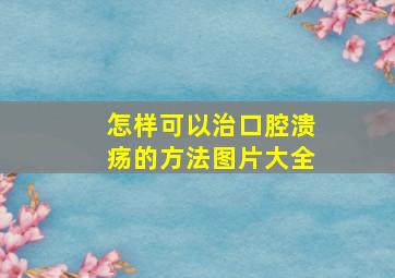 怎样可以治口腔溃疡的方法图片大全