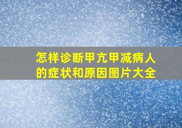 怎样诊断甲亢甲减病人的症状和原因图片大全