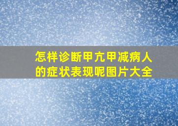 怎样诊断甲亢甲减病人的症状表现呢图片大全