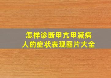 怎样诊断甲亢甲减病人的症状表现图片大全