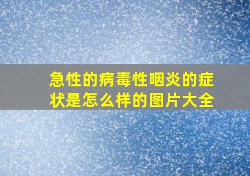 急性的病毒性咽炎的症状是怎么样的图片大全