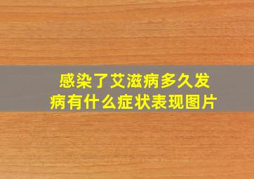 感染了艾滋病多久发病有什么症状表现图片