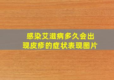 感染艾滋病多久会出现皮疹的症状表现图片