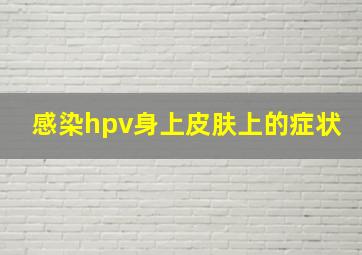 感染hpv身上皮肤上的症状