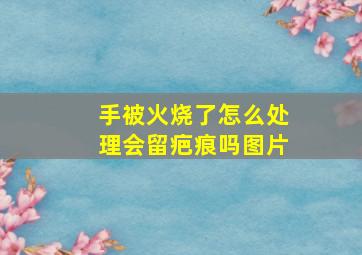 手被火烧了怎么处理会留疤痕吗图片