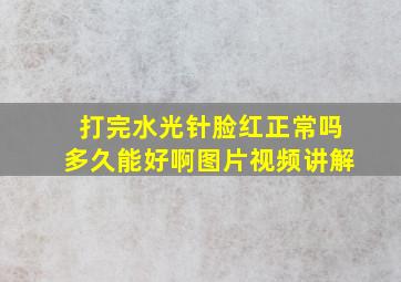 打完水光针脸红正常吗多久能好啊图片视频讲解