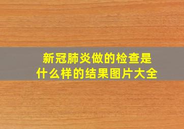 新冠肺炎做的检查是什么样的结果图片大全