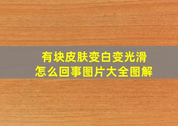 有块皮肤变白变光滑怎么回事图片大全图解